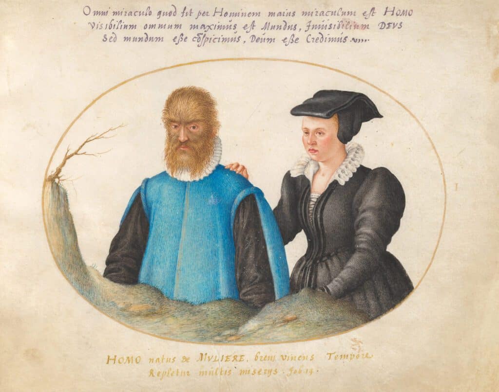 Petrus Gonsalvus e Catherine - Capodimonte - Lago di Bolsena